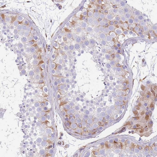 Immunohistochemical staining of human testis shows moderate cytoplasmic positivity in subset of cells in seminiferous ducts and Leydig cells.