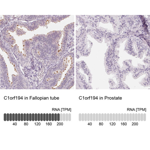 Immunohistochemistry analysis in human fallopian tube and prostate tissues using Anti-C1orf194 antibody. Corresponding C1orf194 RNA-seq data are presented for the same tissues.
