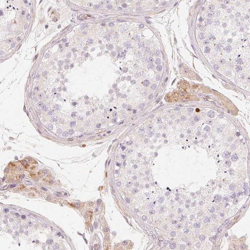 Immunohistochemical staining of human testis shows moderate cytoplasmic positivity in Leydig cells.