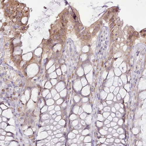 Immunohistochemical staining of human rectum shows moderate cytoplasmic positivity in glandular cells.