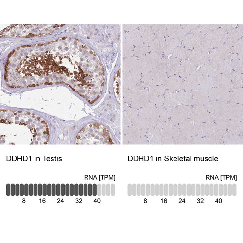 Immunohistochemistry analysis in human testis and skeletal muscle tissues using HPA049870 antibody. Corresponding DDHD1 RNA-seq data are presented for the same tissues.