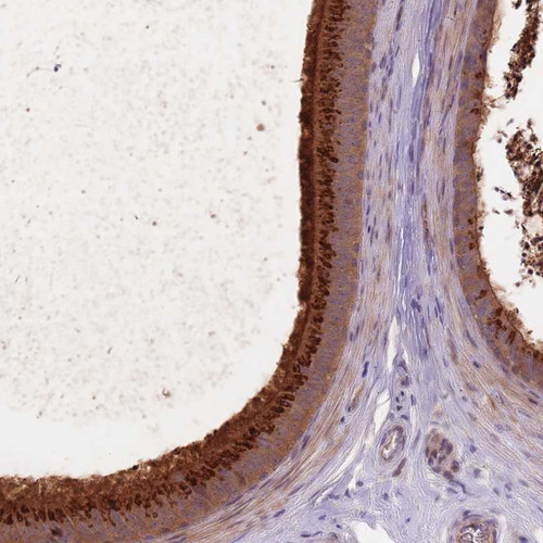 Immunohistochemical staining of human epididymis shows strong cytoplasmic and membranous positivity in glandular cells.