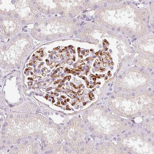 Immunohistochemical staining of human kidney shows strong membranous positivity in cells in glomeruli.