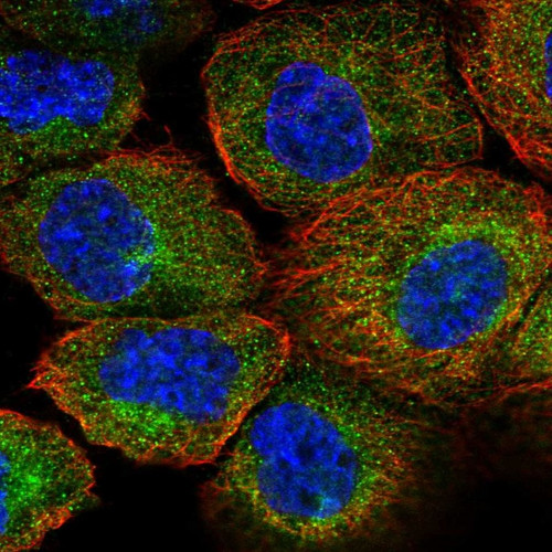 Immunofluorescent staining of human cell line A-431 shows localization to cytosol.
