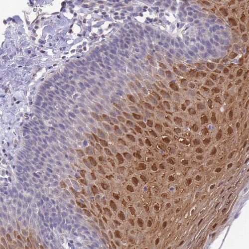 Immunohistochemical staining of human esophagus shows strong nuclear and cytoplasmic positivity in superficial cells of squamous epithelia.
