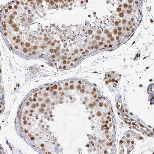 Immunohistochemical staining of human testis shows strong nuclear positivity in cells in seminiferous ducts.