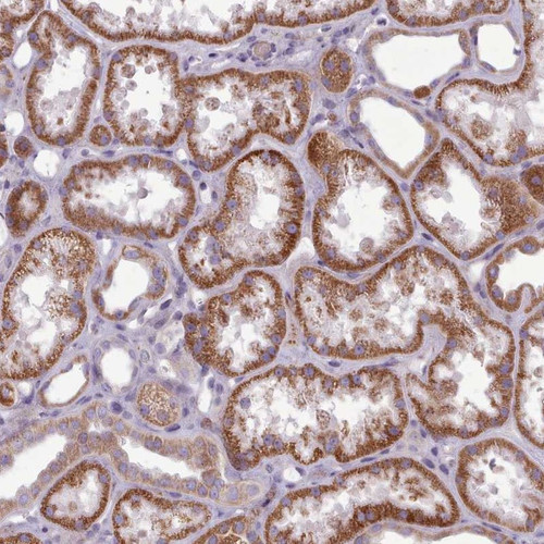Immunohistochemical staining of human kidney shows strong cytoplasmic positivity in cells in tubules.