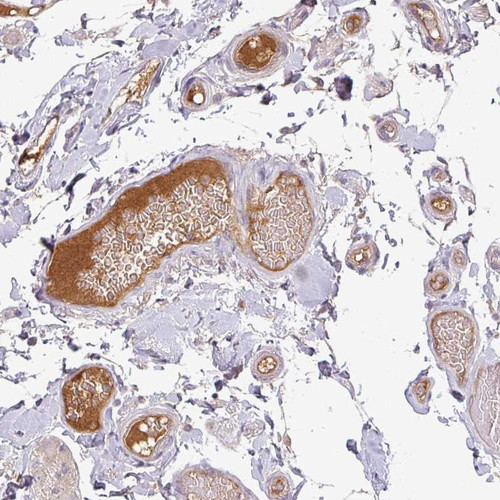 Immunohistochemical staining of human small intestine shows positivity in plasma.