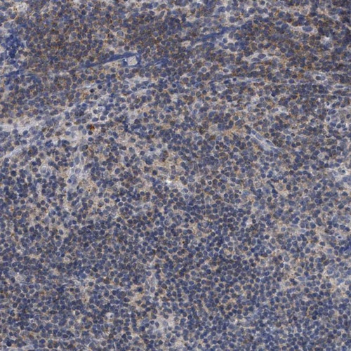 Immunohistochemical staining of human lymph node shows moderate cytoplasmic positivity in non-germinal center cells.