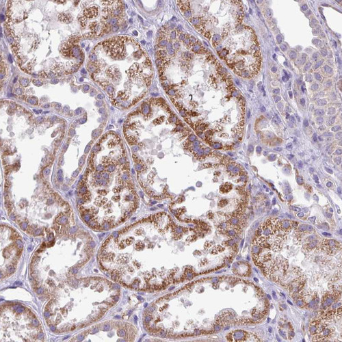 Immunohistochemical staining of human kidney shows strong cytoplasmic positivity in cells in tubules.
