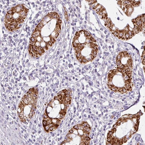 Immunohistochemical staining of human rectum shows strong cytoplasmic positivity in glandular cells.
