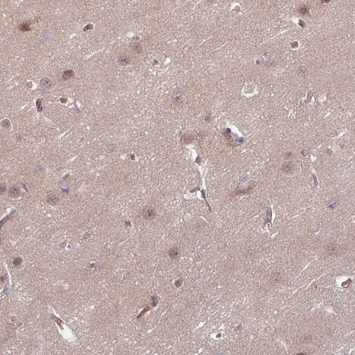Immunohistochemical staining of human cerebral cortex shows moderate positivity in neuropil.