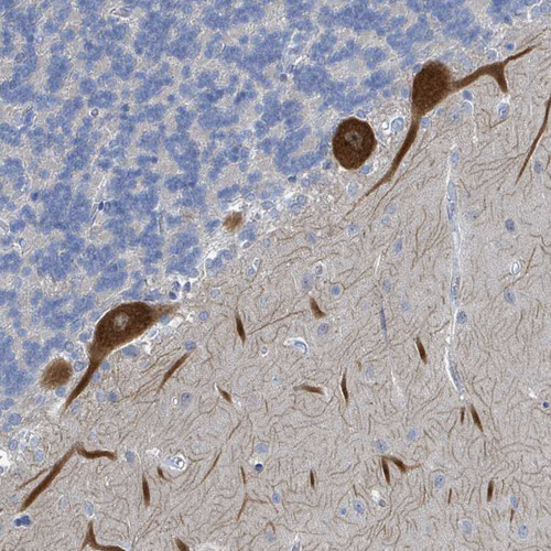 Immunohistochemical staining of human cerebellum shows strong cytoplasmic positivity in purkinje cells.