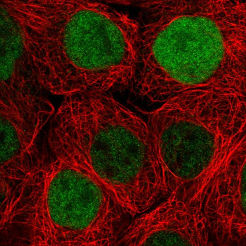 Immunofluorescent staining of human cell line A-431 shows localization to nucleoplasm.