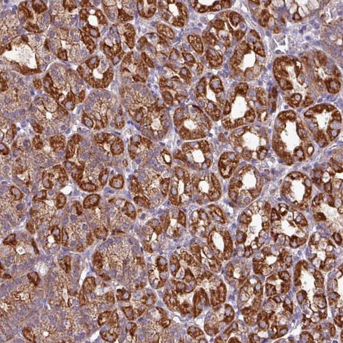Immunohistochemical staining of human stomach, upper shows strong cytoplasmic positivity in glandular cells.