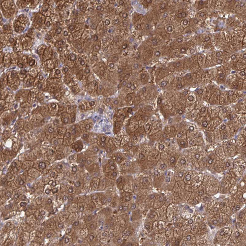 Immunohistochemical staining of human prostate shows strong cytoplasmic positivity in glandular cells.
