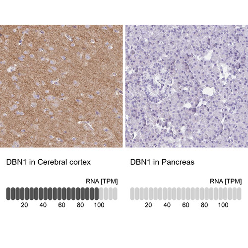Immunohistochemistry analysis in human cerebral cortex and pancreas tissues using Anti-DBN1 antibody. Corresponding DBN1 RNA-seq data are presented for the same tissues.