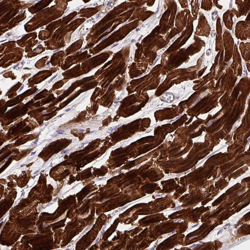 Immunohistochemical staining of human heart muscle shows strong cytoplasmic positivity in myocytes.