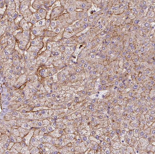 Immunohistochemical staining of human liver shows moderate granular cytoplasmic positivity in hepatocytes.