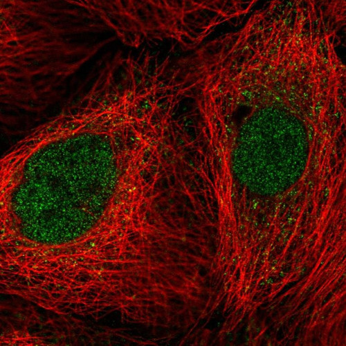Immunofluorescent staining of human cell line A-431 shows localization to nucleoplasm.
