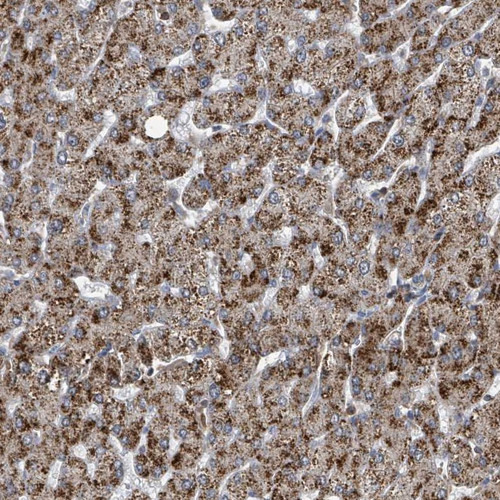 Immunohistochemical staining of human liver shows strong cytoplasmic positivity in hepatocytes.