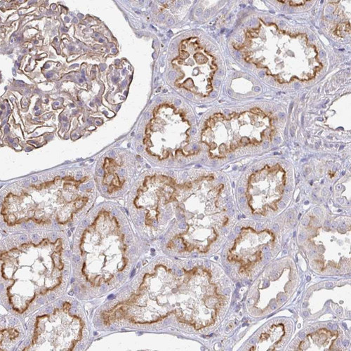 Immunohistochemical staining of human kidney shows strong membranous positivity in cells in tubules.