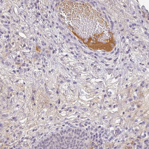 Immunohistochemical staining of human urinary bladder shows plasma positivity.