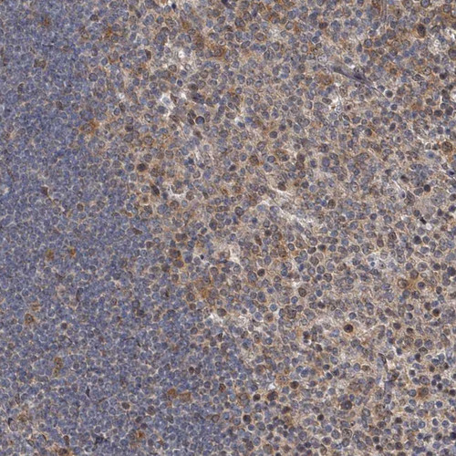 Immunohistochemical staining of human tonsil shows strong cytoplasmic positivity in germinal center cells.