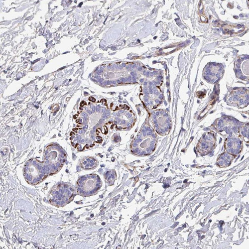 Immunohistochemical staining of human breast shows strong cytoplasmic positivity in myoepithelial cells.