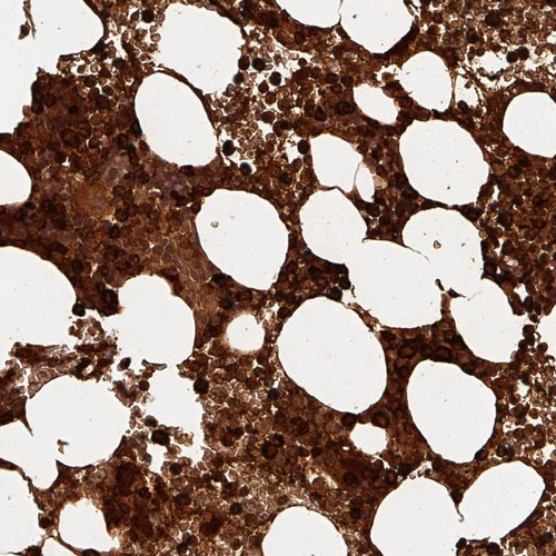 Immunohistochemical staining of human bone marrow shows strong cytoplasmic positivity in hematopoietic cells.