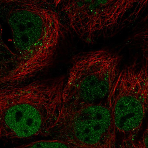 Immunofluorescent staining of human cell line CACO-2 shows localization to nucleoplasm & vesicles.