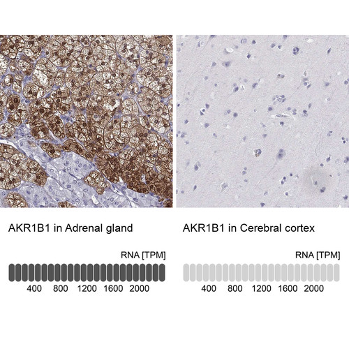 Immunohistochemistry analysis in human adrenal gland and cerebral cortex tissues using Anti-AKR1B1 antibody. Corresponding AKR1B1 RNA-seq data are presented for the same tissues.