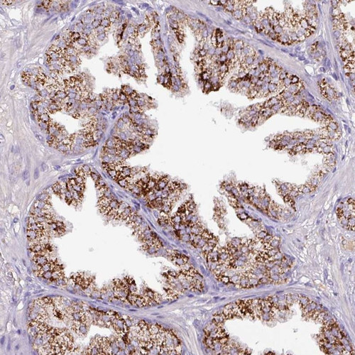 Immunohistochemical staining of human prostate shows strong granular cytoplasmic positivity in glandular cells.