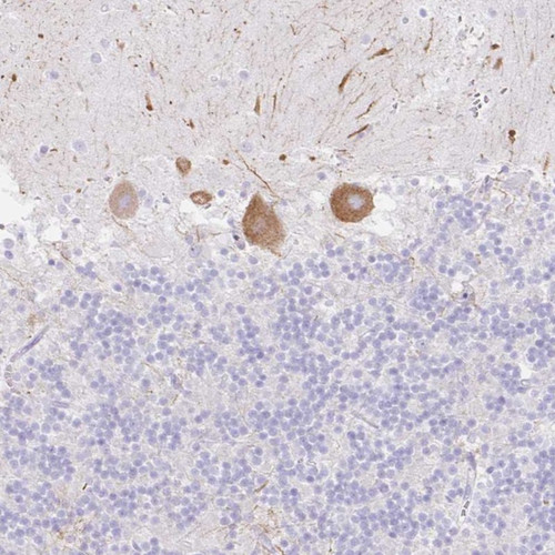 Immunohistochemical staining of human cerebellum shows distinct cytoplasmic positivity in Purkinje cells.