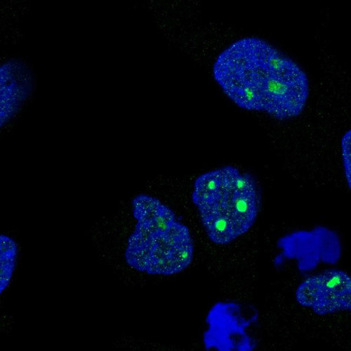 Immunofluorescent staining of human cell line RH-30 shows localization to nucleus & nucleoli.