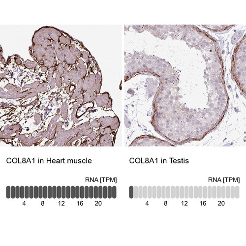 Immunohistochemistry analysis in human lung and cerebral cortex tissues using Anti-COL8A1 antibody. Corresponding COL8A1 RNA-seq data are presented for the same tissues.