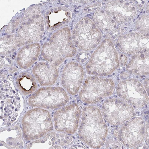 Immunohistochemical staining of human kidney shows strong membranous positivity in cells in tubules.