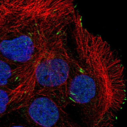 Immunofluorescent staining of human cell line CACO-2 shows localization to nucleoplasm & focal adhesion sites.