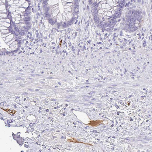 Immunohistochemical staining of human rectum shows moderate positivity in plasma in blood vessels.