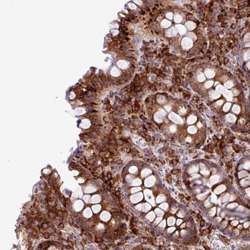 Immunohistochemical staining of human rectum shows strong cytoplasmic positivity in glandular cells.