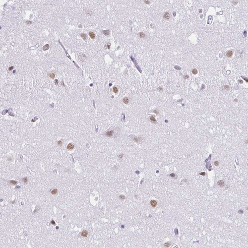 Immunohistochemical staining of human Cerebral cortex shows moderate nuclear positivity in neuronal and glial cells.