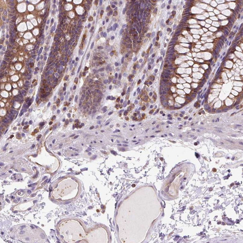 Immunohistochemical staining of human colon shows moderate cytoplasmic positivity in glandular cells.