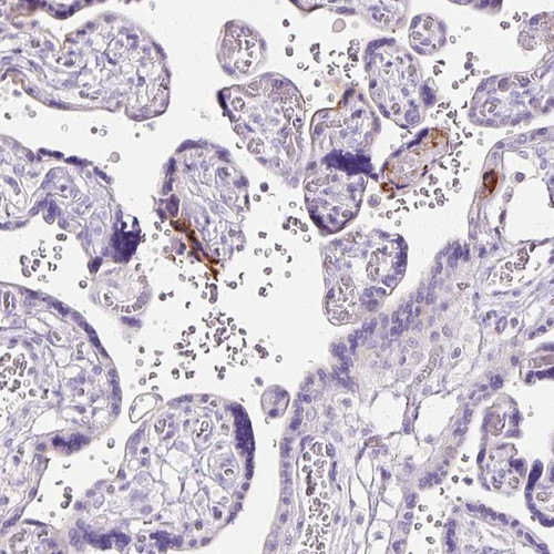 Immunohistochemical staining of human placenta shows strong cytoplasmic positivity in trophoblastic cells.