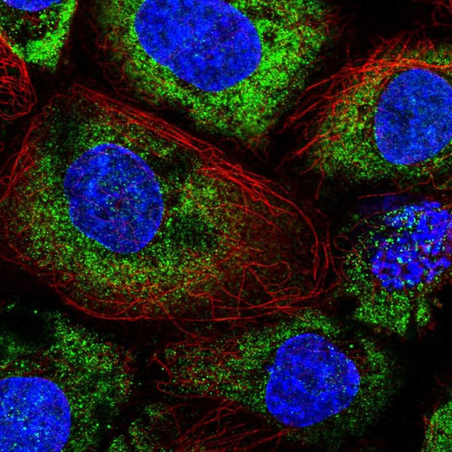 Immunofluorescent staining of human cell line A-431 shows localization to cytosol.