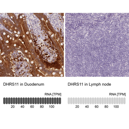 Immunohistochemistry analysis in human duodenum and lymph node tissues using Anti-DHRS11 antibody. Corresponding DHRS11 RNA-seq data are presented for the same tissues.