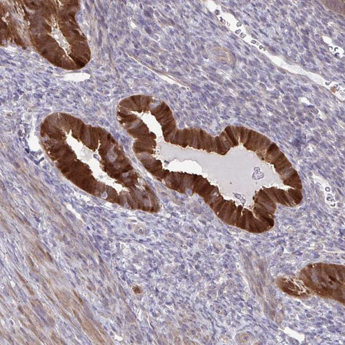 Immunohistochemical staining of human uterus, post-menopause shows strong cytoplasmic positivity in glandular cells.