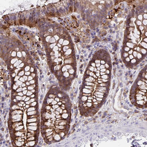 Immunohistochemical staining of human colon shows strong cytoplasmic and membranous positivity in glandular cells.