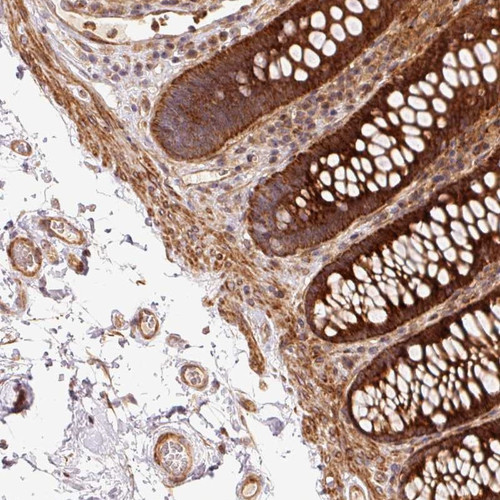 Immunohistochemical staining of human colon shows strong cytoplasmic positivity in glandular cells.