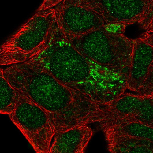 Immunofluorescent staining of human cell line RT4 shows localization to nucleus & mitochondria.
