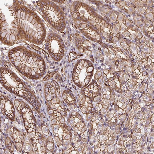 Immunohistochemical staining of human stomach (lower) shows moderate membranous positivity in glandular cells.